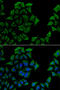 Transcobalamin 1 antibody, STJ28497, St John