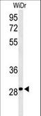 Nicotinamide Riboside Kinase 1 antibody, LS-C168224, Lifespan Biosciences, Western Blot image 