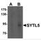 Synaptotagmin Like 5 antibody, MBS150760, MyBioSource, Western Blot image 