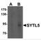 Synaptotagmin-like protein 5 antibody, MBS150760, MyBioSource, Western Blot image 