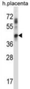 Ubiquitin Conjugating Enzyme E2 J1 antibody, abx028012, Abbexa, Western Blot image 