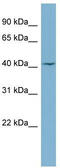 Ceramide Synthase 1 antibody, TA338471, Origene, Western Blot image 