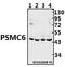 Proteasome 26S Subunit, ATPase 6 antibody, A09249, Boster Biological Technology, Western Blot image 