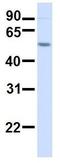 Anoctamin 10 antibody, GTX46308, GeneTex, Western Blot image 