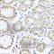 Choriogonadotropin subunit beta antibody, A8522, ABclonal Technology, Immunohistochemistry paraffin image 