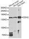 Cadherin 2 antibody, STJ110955, St John