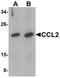 C-C Motif Chemokine Ligand 2 antibody, PA5-34505, Invitrogen Antibodies, Western Blot image 