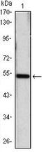 Sonic hedgehog protein antibody, MA5-15647, Invitrogen Antibodies, Western Blot image 