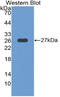 Thrombospondin Type 1 Domain Containing 7A antibody, LS-C315036, Lifespan Biosciences, Western Blot image 