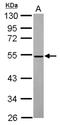 MDIG antibody, NBP2-17292, Novus Biologicals, Western Blot image 