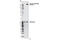 Erb-B2 Receptor Tyrosine Kinase 3 antibody, 4561S, Cell Signaling Technology, Western Blot image 