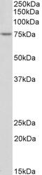 Alpha-2-Macroglobulin antibody, 43-524, ProSci, Western Blot image 