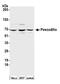 Pescadillo Ribosomal Biogenesis Factor 1 antibody, NB110-40548, Novus Biologicals, Western Blot image 