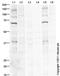 Checkpoint Kinase 2 antibody, ab85743, Abcam, Western Blot image 