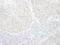 GLI Family Zinc Finger 3 antibody, NBP1-79019, Novus Biologicals, Immunohistochemistry paraffin image 