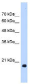 Heat shock protein beta-6 antibody, TA346656, Origene, Western Blot image 