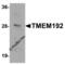 Transmembrane Protein 192 antibody, 6227, ProSci Inc, Western Blot image 