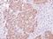 Charged Multivesicular Body Protein 5 antibody, PA5-21787, Invitrogen Antibodies, Immunohistochemistry paraffin image 