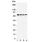 TNF Receptor Superfamily Member 1B antibody, R31080, NSJ Bioreagents, Western Blot image 