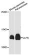 Colipase antibody, STJ114645, St John