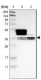 Heterogeneous Nuclear Ribonucleoprotein A1 antibody, NBP2-14096, Novus Biologicals, Western Blot image 