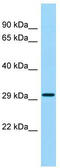 Retroviral-like aspartic protease 1 antibody, TA337970, Origene, Western Blot image 