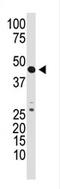 Growth Differentiation Factor 3 antibody, AP11942PU-N, Origene, Western Blot image 