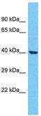 Olfactory Receptor Family 4 Subfamily F Member 21 antibody, TA337507, Origene, Western Blot image 