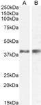 Interleukin 12B antibody, LS-C55003, Lifespan Biosciences, Western Blot image 