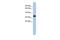 Major Histocompatibility Complex, Class II, DP Alpha 1 antibody, GTX45903, GeneTex, Western Blot image 