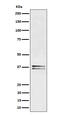 Linker For Activation Of T Cells antibody, M01654-1, Boster Biological Technology, Western Blot image 