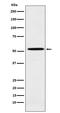 Aldehyde Dehydrogenase 1 Family Member A2 antibody, M04961, Boster Biological Technology, Western Blot image 