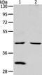 Neutral cholesterol ester hydrolase 1 antibody, PA5-50285, Invitrogen Antibodies, Western Blot image 