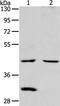 Neutral Cholesterol Ester Hydrolase 1 antibody, PA5-50285, Invitrogen Antibodies, Western Blot image 