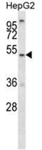 ALG11 Alpha-1,2-Mannosyltransferase antibody, AP50146PU-N, Origene, Western Blot image 