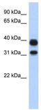 Chitinase Acidic antibody, TA329462, Origene, Western Blot image 