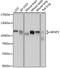 Kinesin Associated Protein 3 antibody, A07239, Boster Biological Technology, Western Blot image 