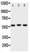 Pyruvate Kinase M1/2 antibody, PA2046, Boster Biological Technology, Western Blot image 