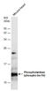 Phospholamban antibody, GTX132818, GeneTex, Western Blot image 