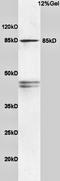 Phosphoinositide-3-Kinase Regulatory Subunit 1 antibody, orb11271, Biorbyt, Western Blot image 