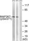 Mitogen-Activated Protein Kinase Kinase 7 antibody, AP55764PU-S, Origene, Western Blot image 