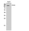 Collagen Type IX Alpha 1 Chain antibody, A04554, Boster Biological Technology, Western Blot image 