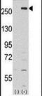 Lemur Tyrosine Kinase 2 antibody, PA5-13937, Invitrogen Antibodies, Western Blot image 