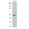 CCAAT Enhancer Binding Protein Alpha antibody, LS-C381190, Lifespan Biosciences, Western Blot image 