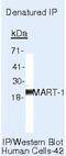 Melan-A antibody, MA5-15237, Invitrogen Antibodies, Immunoprecipitation image 