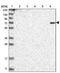 Denticleless E3 Ubiquitin Protein Ligase Homolog antibody, PA5-55750, Invitrogen Antibodies, Western Blot image 
