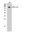 Component Of Inhibitor Of Nuclear Factor Kappa B Kinase Complex antibody, STJ90300, St John