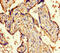 Origin Recognition Complex Subunit 4 antibody, A54848-100, Epigentek, Immunohistochemistry paraffin image 