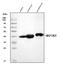 Mitogen-Activated Protein Kinase Kinase 6 antibody, A02011-3, Boster Biological Technology, Western Blot image 