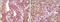 B-Raf Proto-Oncogene, Serine/Threonine Kinase antibody, NBP1-47555, Novus Biologicals, Immunohistochemistry frozen image 